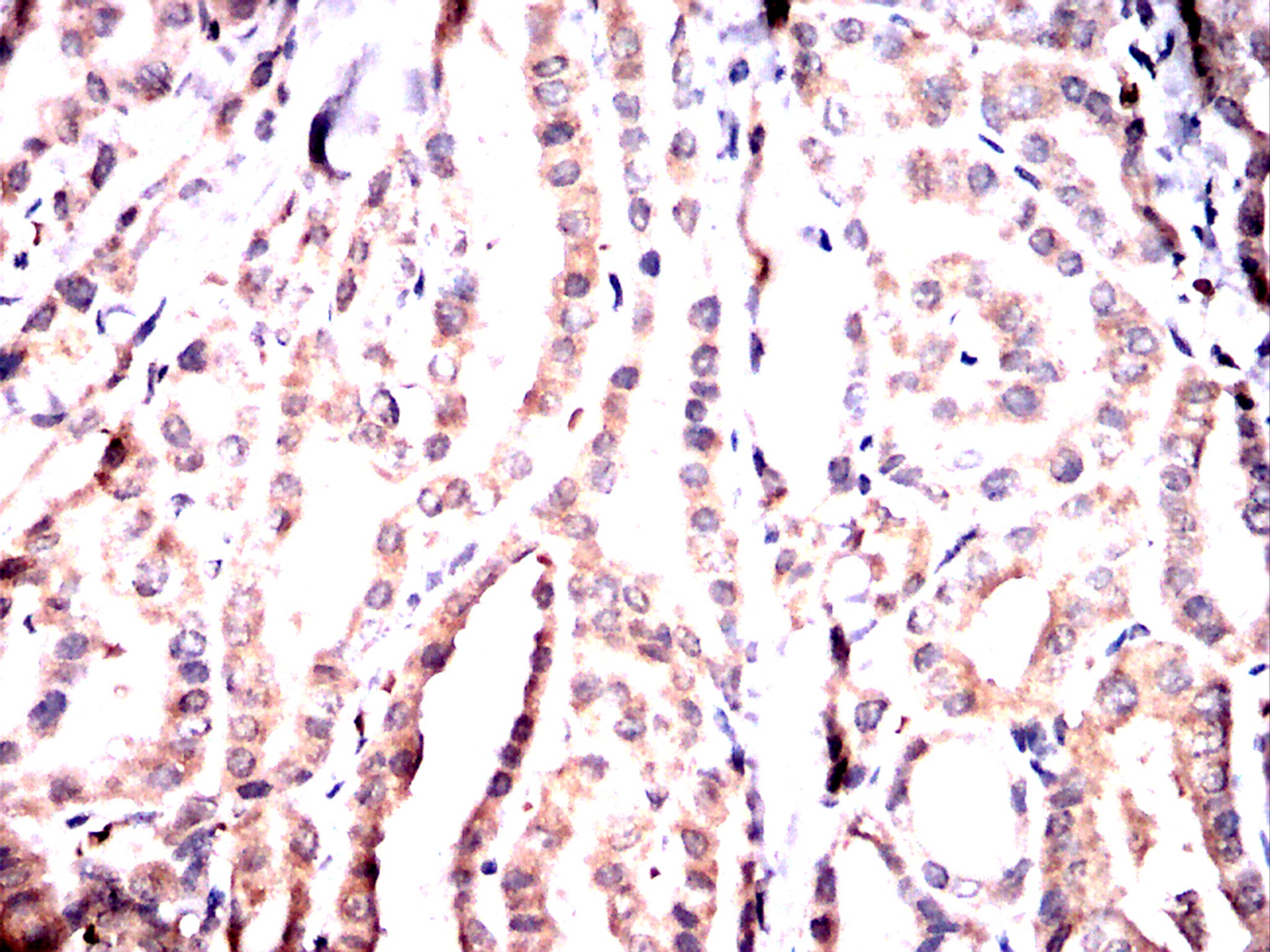 IHC 